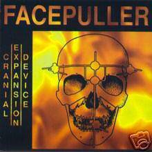 Facepuller : Cranial Expansion Device